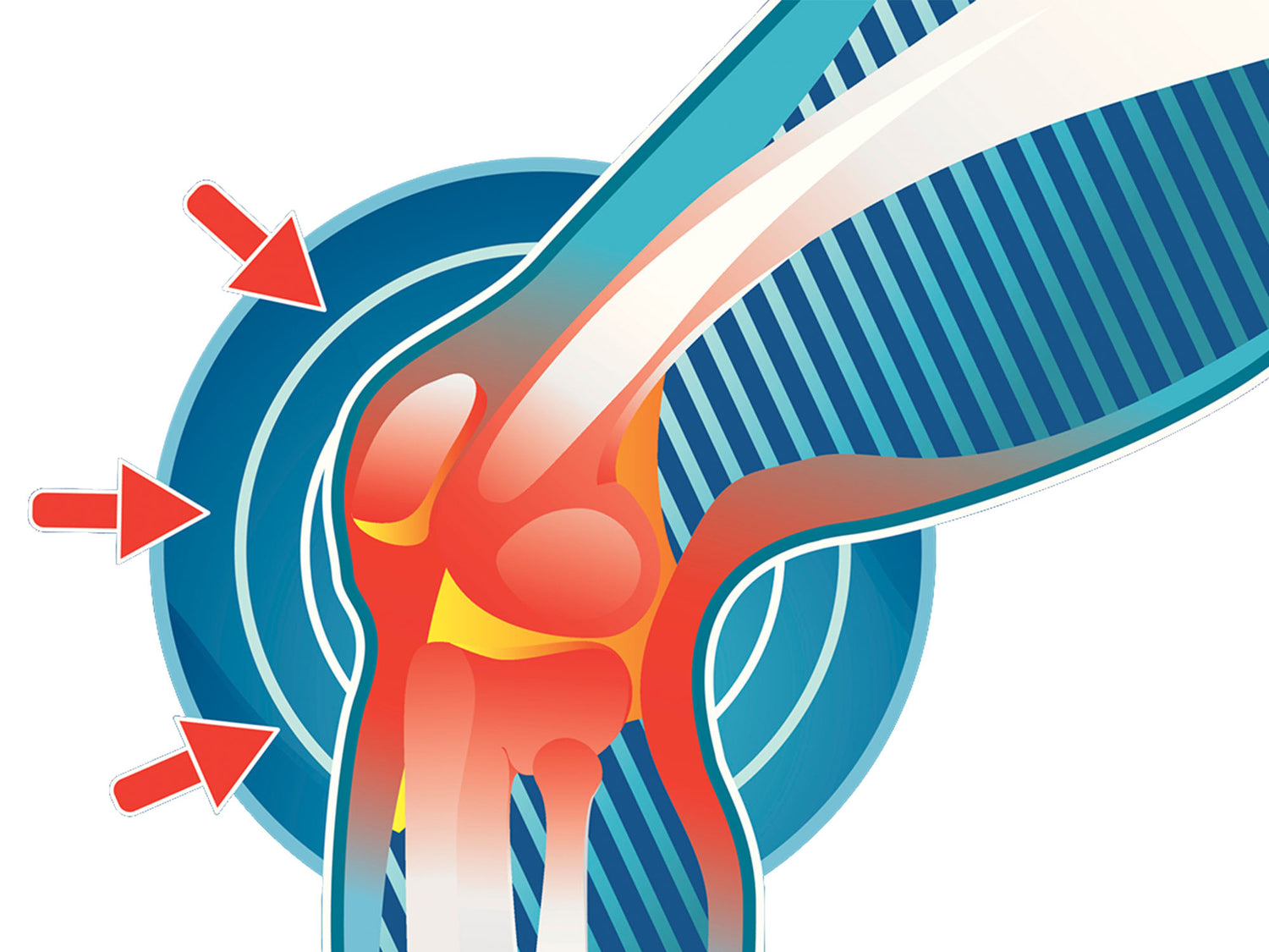 Early signs and treatments of knee injuries